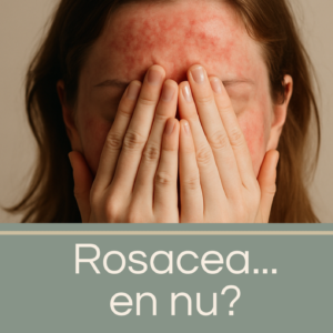 Rosacea... en nu?